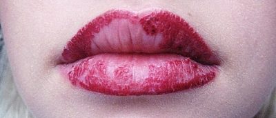 Перманентный макияж губ заживление по дням