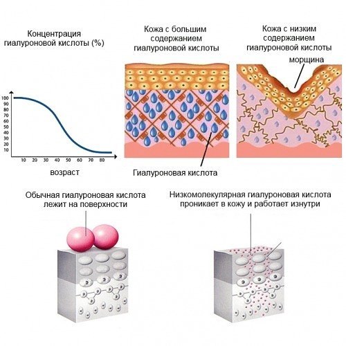 Гиалуроновая кислота в каких продуктах она есть